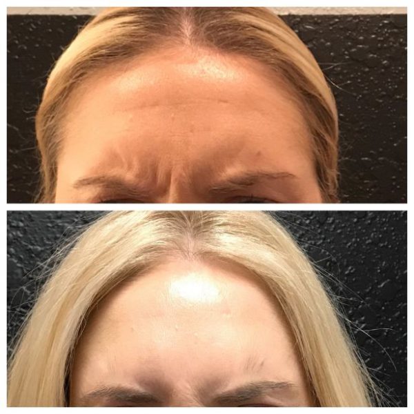 botox1290 Medical Spa Houston & ster, TX M Spa Face and Body